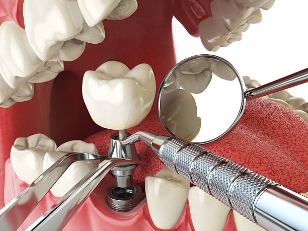 Best Emergency Dental Surgery in Laingsburg, MI